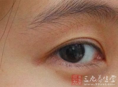 体检可见眼结膜、鼻黏膜和咽部充血