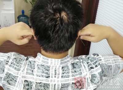 使新陈代谢活拨的简单耳朵按摩动作 使新陈代谢活拨的简单耳朵按摩动作