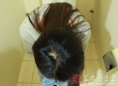 粪便的形状也是分辨它是否健康的根据之一