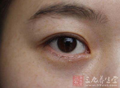 眼睛并没有什么毛病，但医生却给自己检查眼底