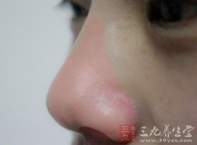 我国治疗癌症比外国多了一条中医中药的途径 我国治疗癌症比外国多了一条中医中药的途径