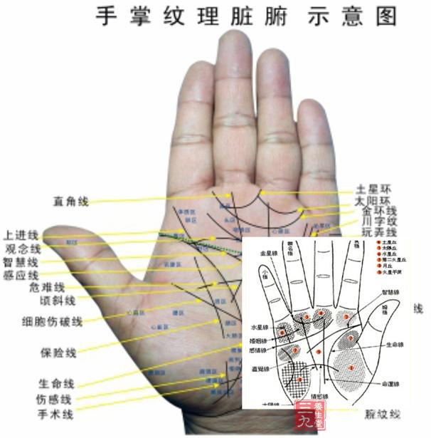 假如把双手通贯手作为一种染色体病的诊断指标