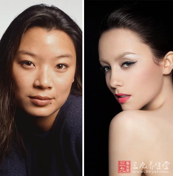 亚临床甲减的预防 怎么预防亚临床甲减