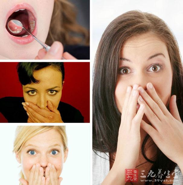 各阶段女性口臭治疗