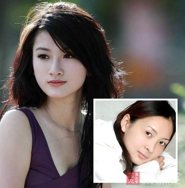 眼睛跳的饮食方法 常食蔬果有助于眼睛健康(3