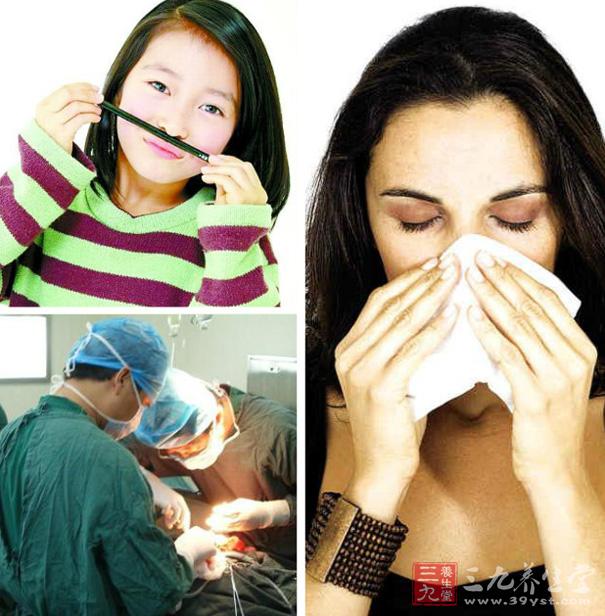 手术治疗鼻息肉的八种注意事项(3)