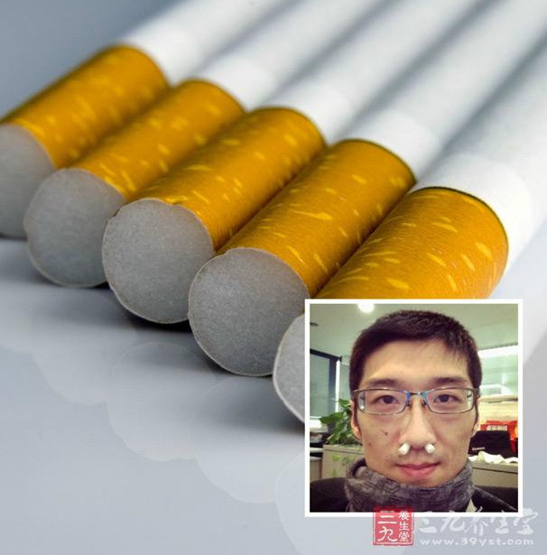 过滤嘴成鼻塞