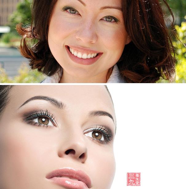 亚临床甲减的饮食 注意合理饮食(2)