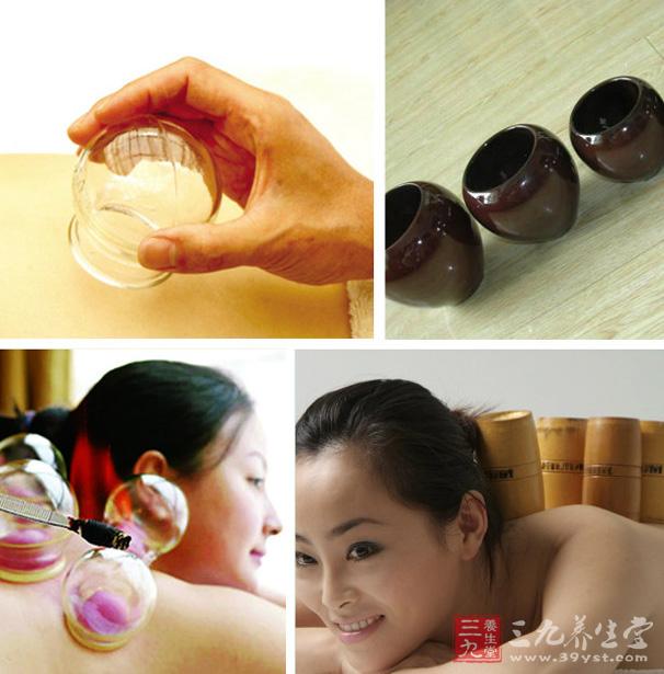 2、刺血拔罐法