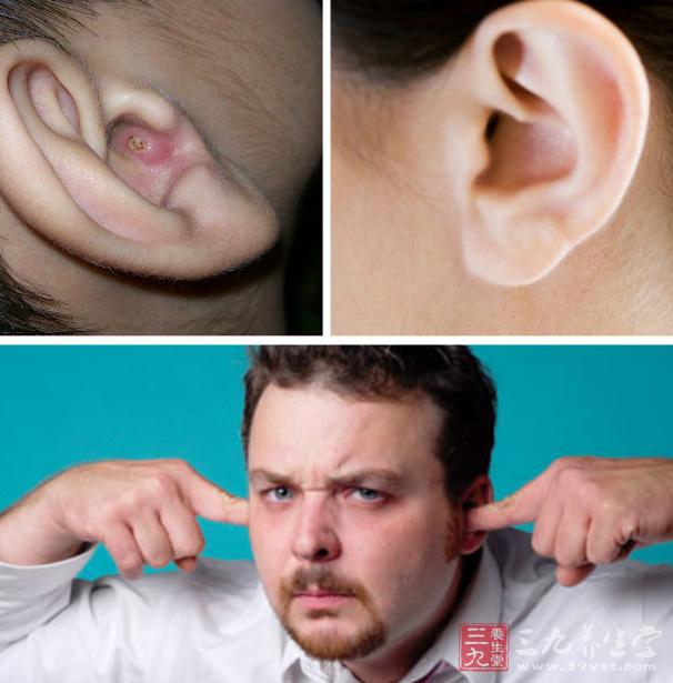 弥漫性外耳道炎是怎么引起的