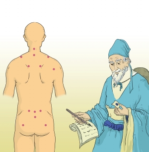 聚焦三伏贴：每伏第一天敷贴效果佳