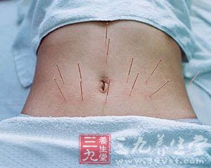 快速燃脂肪的针灸疗法