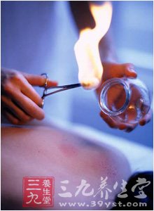 中医拔火罐保健康