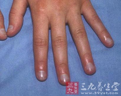 十个危险信号 自测身体亚健康