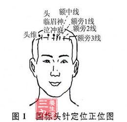 旅途失眠多按按八个“助眠穴”