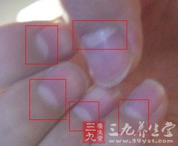 看指甲半月痕 了解身体健康状况