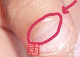 看指甲半月痕 了解身体健康状况