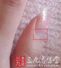 看指甲半月痕 了解身体健康状况