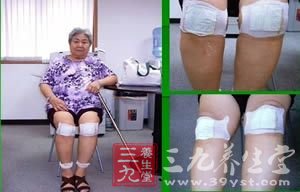 中医妙方帮你防治春季水肿