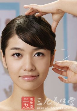 中医针灸让你速变“巴掌”美人