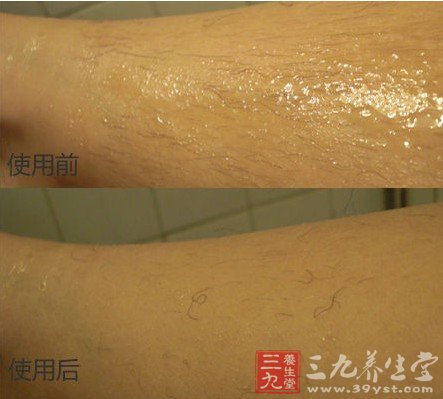 打造光滑肌 夏日脱毛产品测试