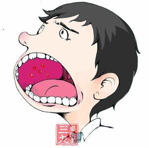 中医养生:9大上火症状 可用食疗轻松解决