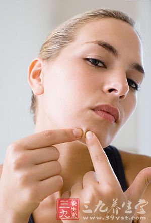 服避孕药也祛痘 扫盲祛痘5误区