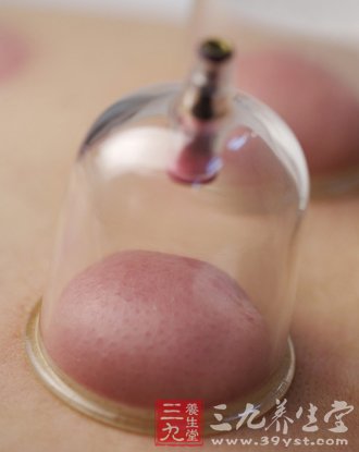 中医养生 在家拔火罐的4大注意事项