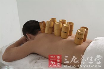 拔罐的好处 治疗健忘