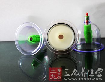 拔罐的好处 治疗健忘