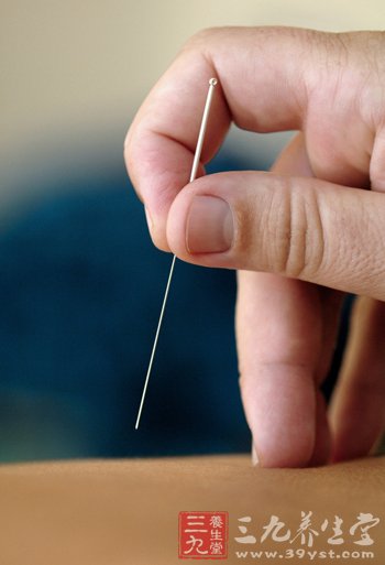 中医近视的针灸疗法