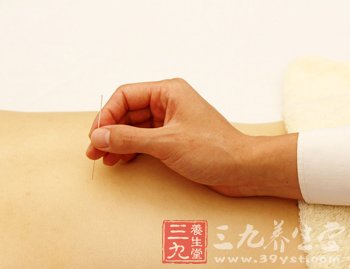 针灸减肥最常使用的五种方法