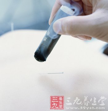 减肥瘦身的艾灸疗法