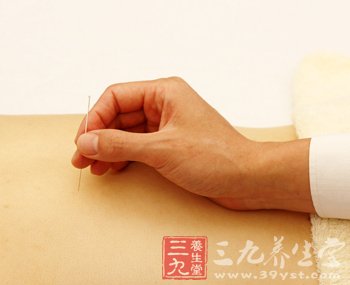 中医针灸可让脂肪消失