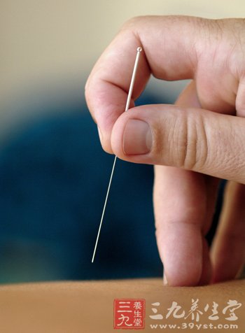 针灸美容抗皱 取哪些穴位好