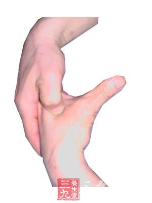 三阴交穴治肾绞痛