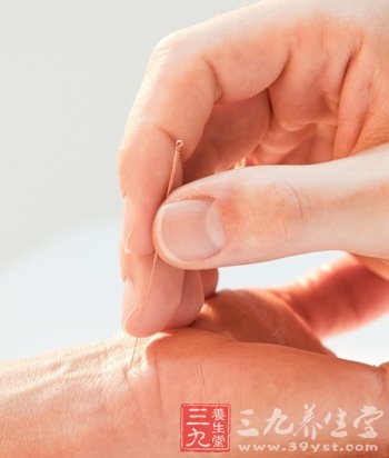 掌握针灸瘦身的要点