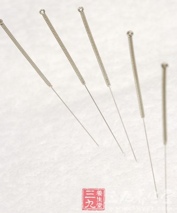 掌握针灸瘦身的要点