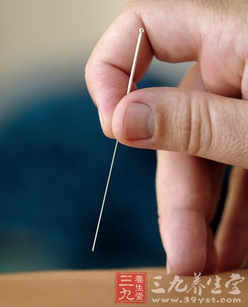 中医针灸帮你来去火