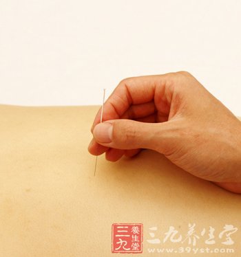 中医针灸帮你来去火