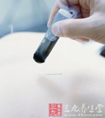 常灸百会穴治疗头痛症(2)