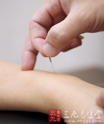 针灸帮你去掉秋季火气