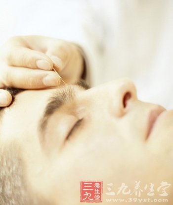 针灸帮你去掉秋季火气