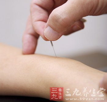 针灸减肥最常使用的方法