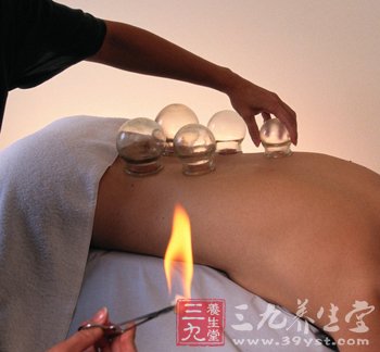拔罐五点注意让人身体平安
