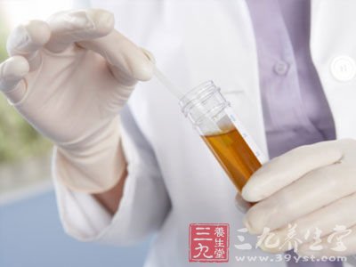 观察第一泡尿的颜色