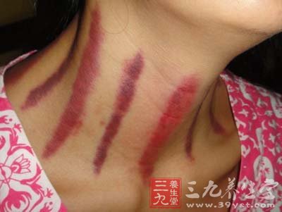中医传统刮痧疗法 让皮肤调柔腠理致密