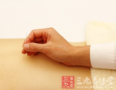 中医疗法揭秘 全面认识传统针灸