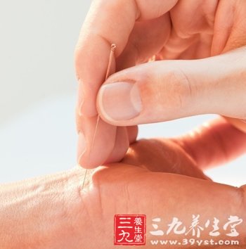 中医针灸注意事项