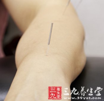 中医针灸注意事项
